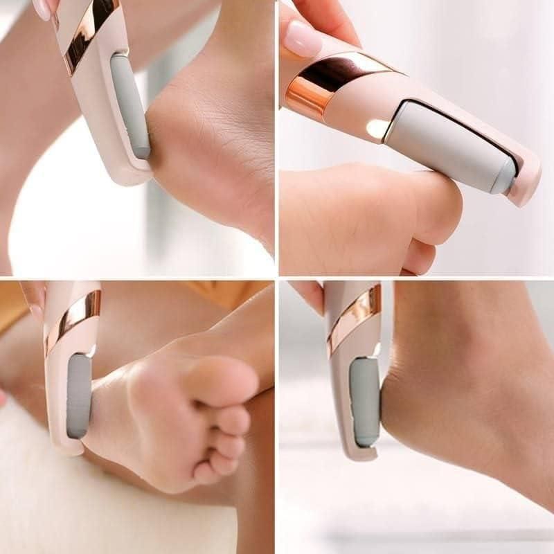 Cordless Electric Foot Callus Remover – Pedicure & Dead Skin Tool - UrbanTeer