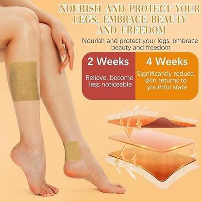 Herbal Turmeric Varicose Vein Relief Patches - UrbanTeer 